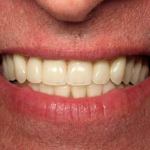 Facial Appearance
