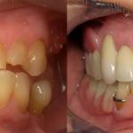 Before | After