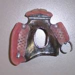 Removable Partial