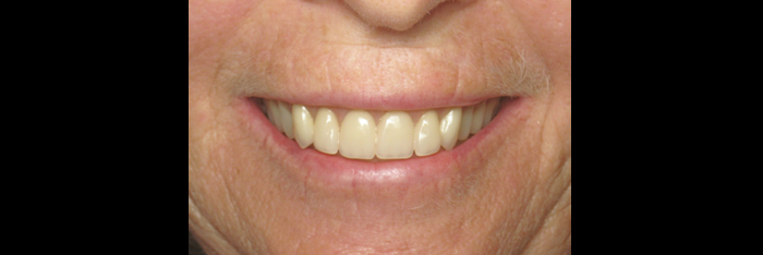 Facial Appearance