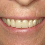Facial Appearance