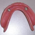 Lower Denture